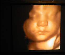 3d ultrasound, 4d ultrasound, ultrasound, sonogram, pregnancy, baby, san diego ultrasound